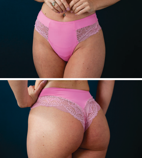 Calcinha Fio - Rosa - Imagem 2