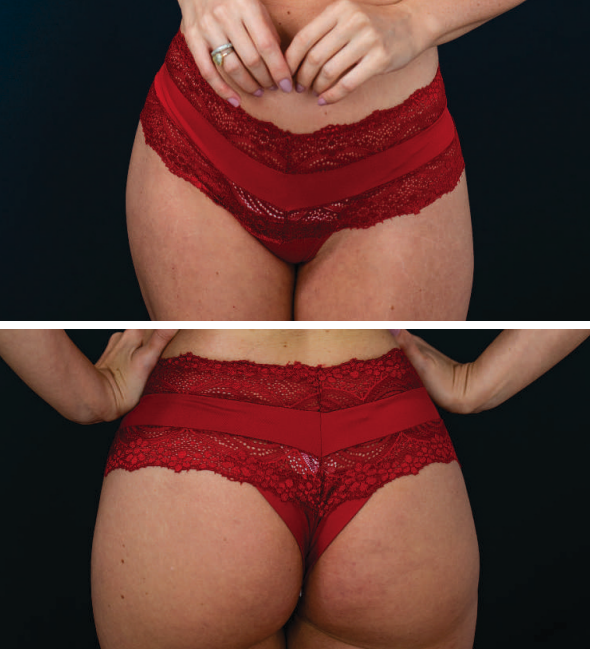 Calcinha Fio - Vermelho - Imagem 2